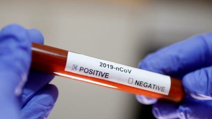 دراسة: اختباء فيروس كورونا في الجسم يُؤخر العلاج