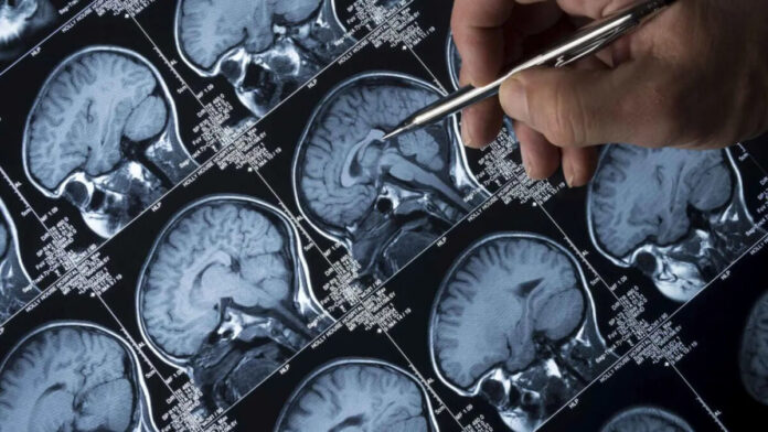 العلاقة بين «الجينات والاكتئاب».. دراسة تكشف 300 تغيّراً مرتبطاً به