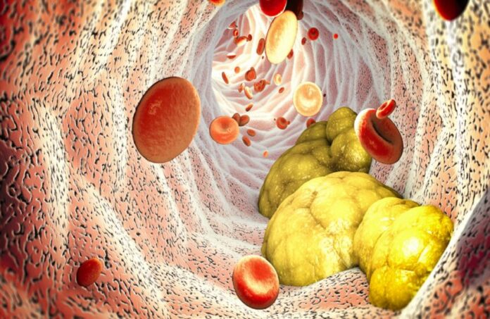 خطر قاتل.. «دهون العضلات» هل تقود للوفاة؟