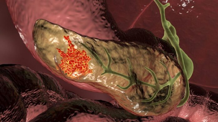 ثورة في علاج أخطر نوع من «السرطانات»