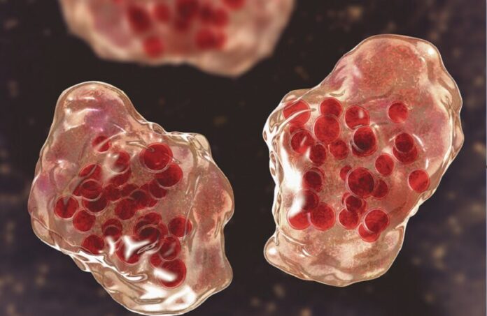 أمريكا.. انتشار واسع لمرض «الحصبة» والسلطات تستنفر