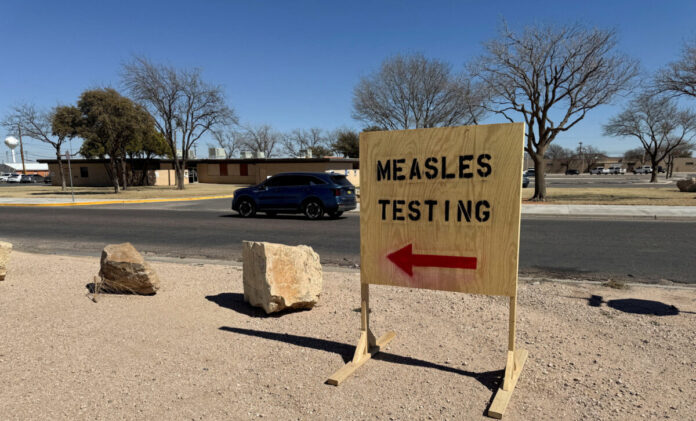 «الحصبة» تفتك بأمريكا.. وفيات ومئات الإصابات والصحة تستنفر