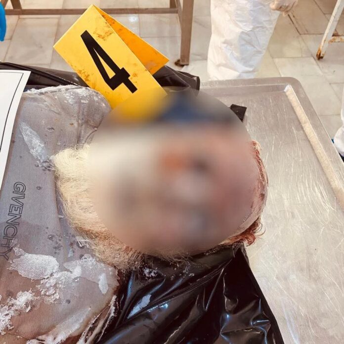 العثور على جثث مجهولة الهوية داخل ثلاجة بـ«مستشفى الحوادث» في أبوسليم